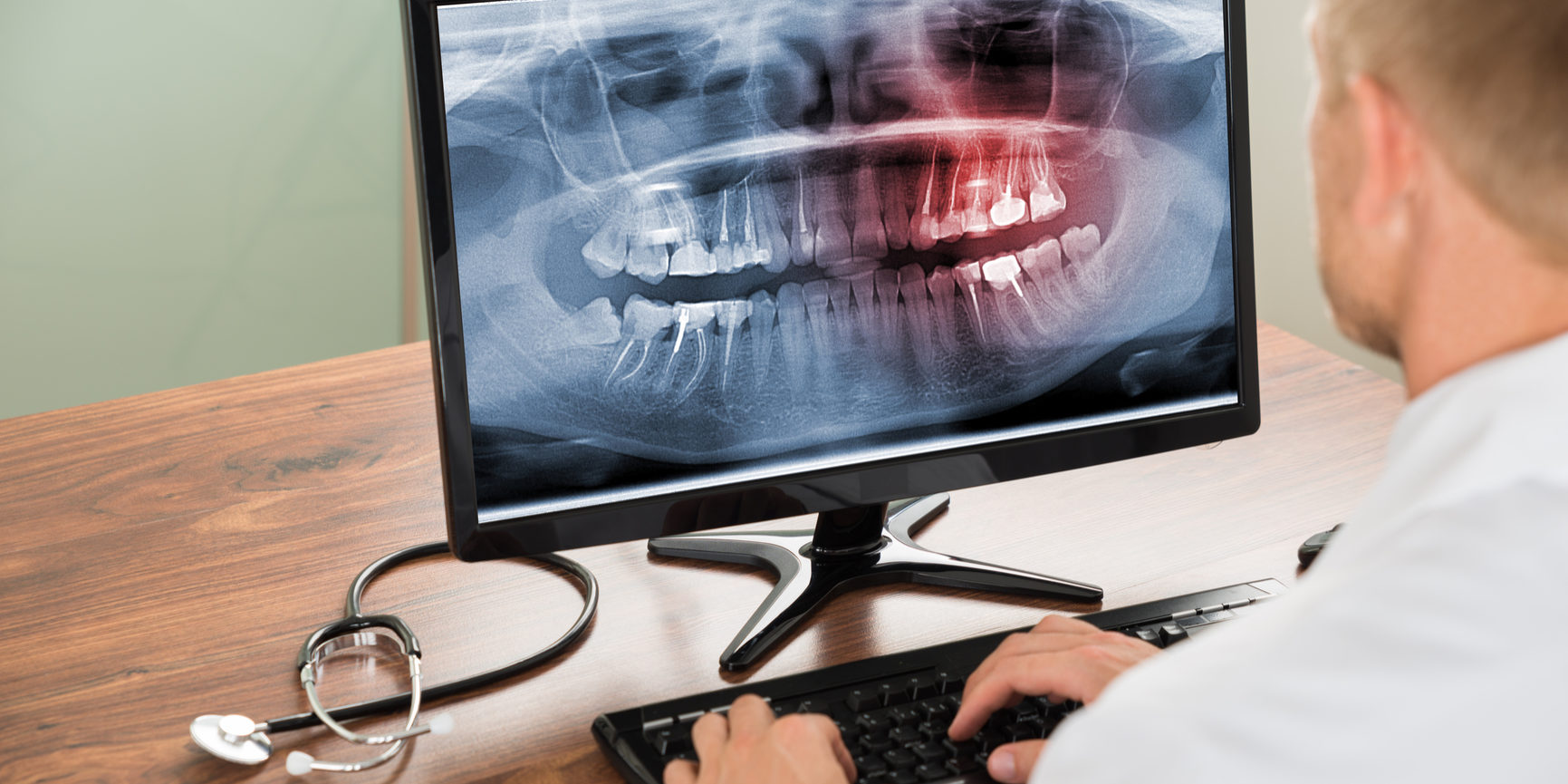 Close-up Of Male Doctor Looking At Teeth X-ray On Computer In Hospital